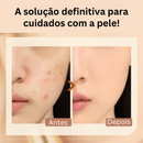 2 em 1 - Base em bastão antirrugas de luxo (COMPRE 2 FRETE GRÁTIS SOMENTE HOJE)