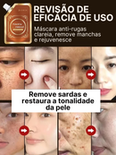 ClariMask - Máscara Anti-Manchas e Antienvelhecimento (Certificada Clinicamente)